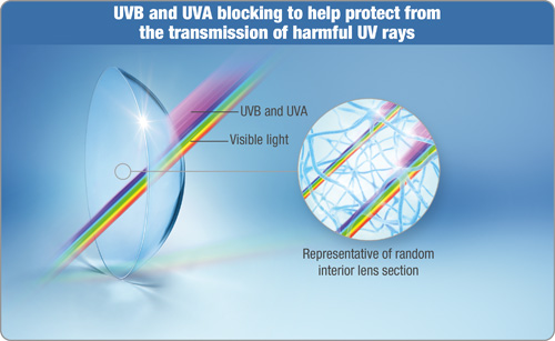ACUVUE OASYS® for ASTIGMATISM Contact Lenses have the highest level of UV-blocking in a re-usable contact lens.